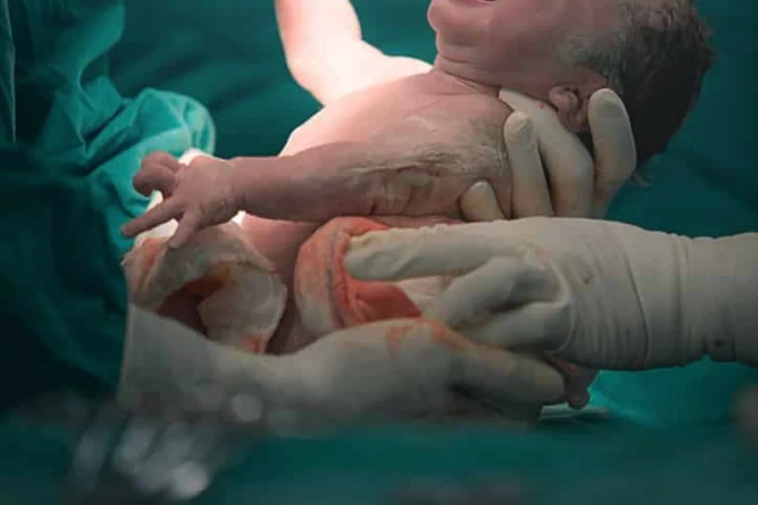 Endişe verici tablo: Azerbaycan’da sezaryen doğumlar normal doğumları geride bırakıyor