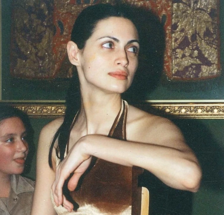 Azerbaycanlı Güzellik İkonu Kansere Karşı Mücadelede