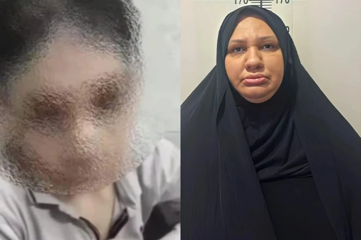 Cehennemden kurtuluş: Bakü’de 14 yaşındaki yetimin vasi işkenceleri ortaya çıktı