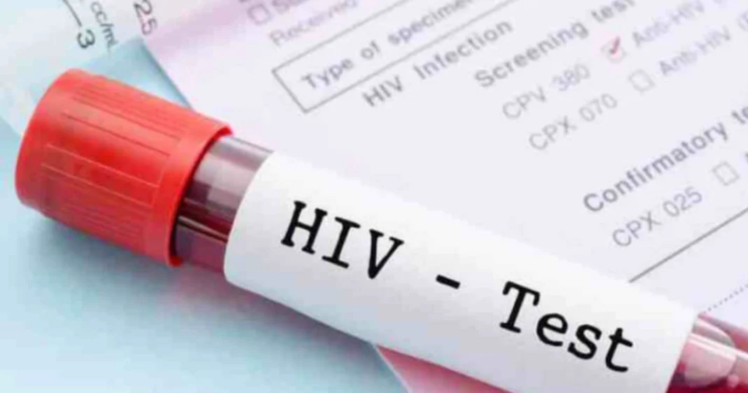 Azerbaycan’da HIV ve Frengi Vakaları Artışta